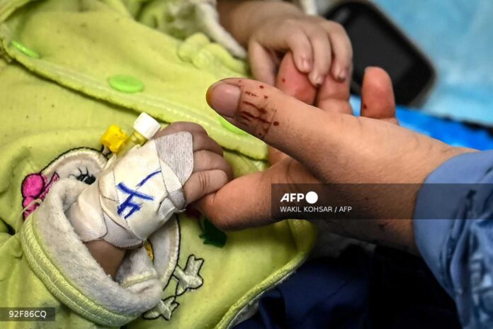 Mother And Malnourished Child In Afghanistan