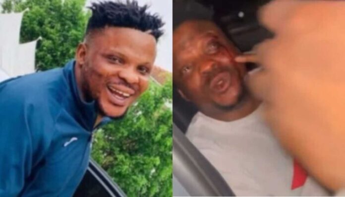 Ijoba Lande Actor Police Assault